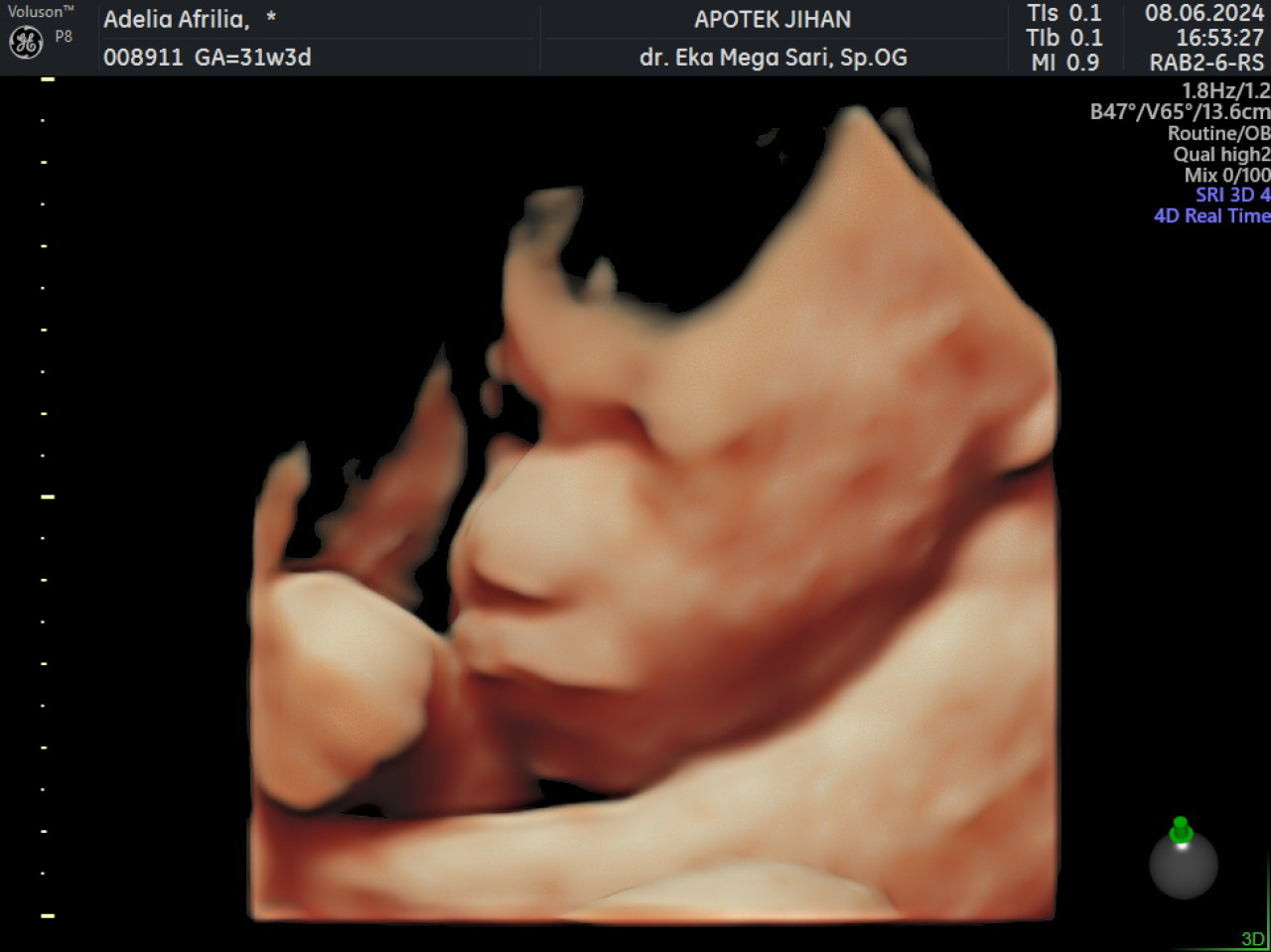 14074-gallery-1657368760.png